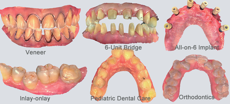 XL013 Dental Aoralscan 3